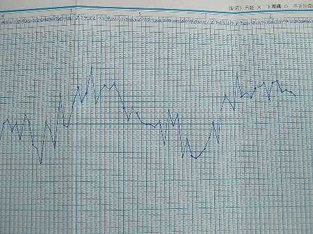基礎体温グラフ
