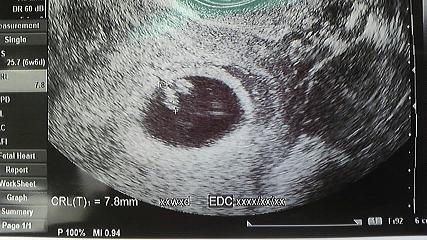 妊娠検査薬の陽性