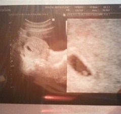 経腹プローブの写真