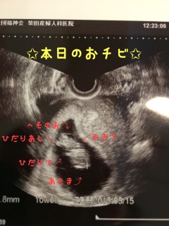 エコー写真