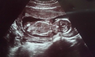 妊娠16w0dのエコー写真 ページ3