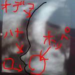 エコー写真
