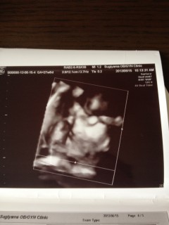 エコー写真