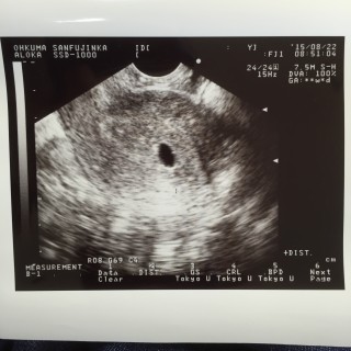 エコー写真
