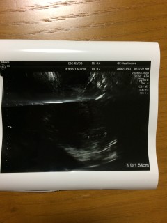 エコー写真