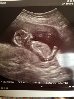 妊娠14週4日 14w4d の超音波 エコー 写真