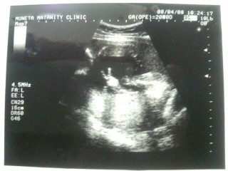 妊娠週0日 w0d の超音波 エコー 写真