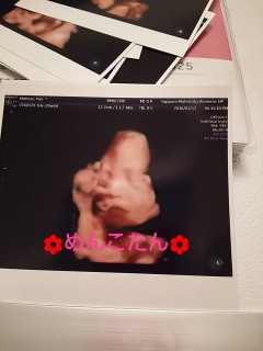 エコー写真