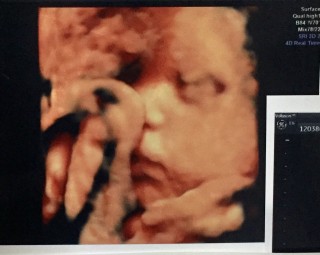 妊娠34週0日 34w0d の超音波 エコー 写真