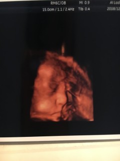 妊娠36週5日 36w5d の超音波 エコー 写真