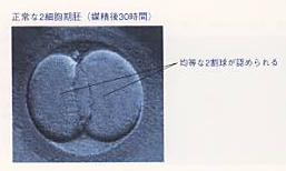 2細胞期胚
