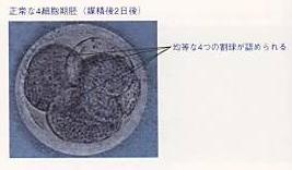 4細胞期胚