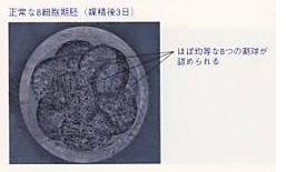 8細胞期胚