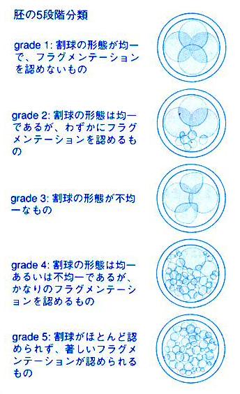 胚のグレード
